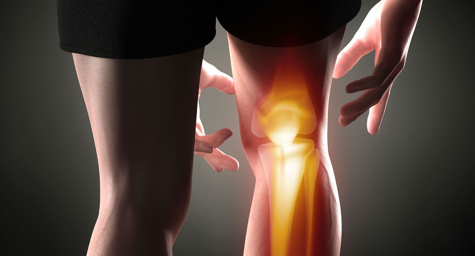Diagnosi differenziale del dolore anteriore di ginocchio